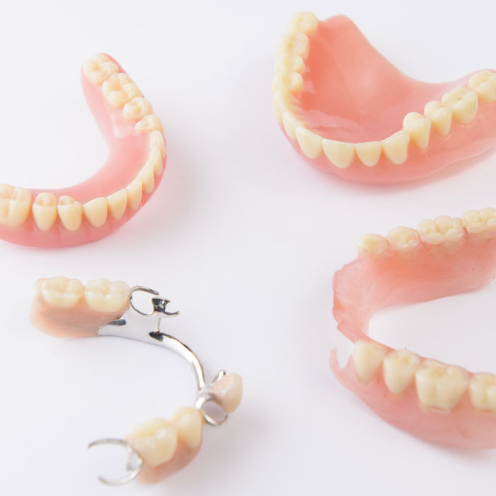 Couronne, bridge, prothèse amovible : les prothèses dentaires